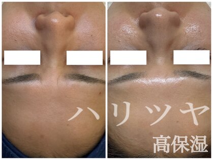 リノ(lino)の写真