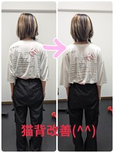 松葉整骨院/肩こりと肩 &nbsp;背中の膨らみ、、、