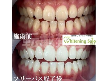 ホワイトニングサロン 広島店の写真/【広島・歯科提携サロン】高い実績口コミエリアTOPレベル!丁寧なカウンセリングでホワイトニング初心者◎