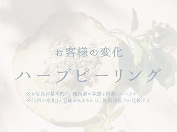 ラシック 加古川店(La chic.)/肌荒れ・ザラつきを根本から