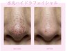 【人気No.2】手強い毛穴汚れも◎ハイドラ×RFでぷるつや韓国美肌へ♪¥9800→