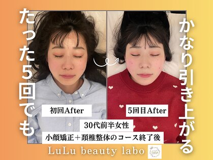 ルルラボ(LuLu beauty labo)の写真