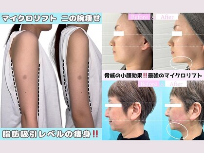 カンナムビューティー 新大久保店【ララピール/ハーブピーリング/小顔矯正/毛穴洗浄】の写真