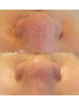 サロンドリー(salon de Re)/超音波エクストラクション