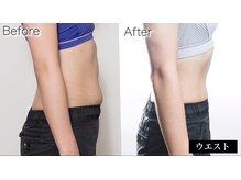 ブーケ 中野店(Bouquet)/お客様のビフォーアフター5