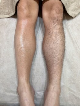 ナチュラヒルズ(Naturahills)/