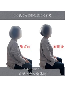 ルチルス(Rutilis)/６０代でも姿勢は変われます