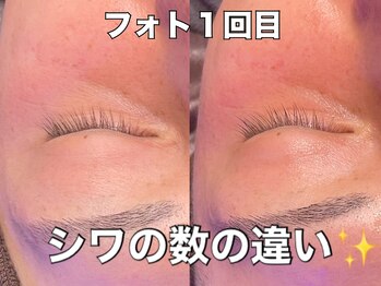 リエル(RIEL)/【フォト】