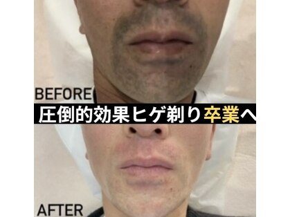 グランツ(GLANZ)の写真