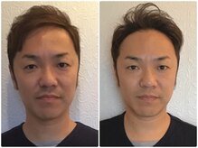 ウェリナ平和堂長久手院/小顔矯正/骨盤矯正/美脚サロン