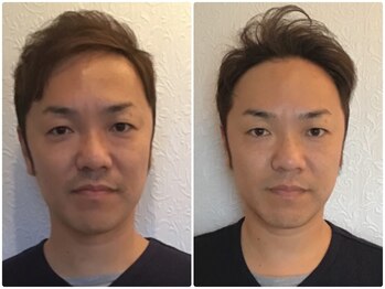 ウェリナ平和堂長久手院/小顔矯正/骨盤矯正/美脚サロン