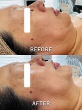 ルーク(Luke)/くすみ・たるみケア