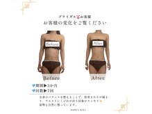 身体の歪みを整え、美しいウエストラインに★