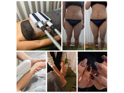 ビーアット(b-atto)の写真