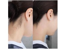 実は視線が集まるうなじ。ワックスでつるんと瞬間うなじ美人に♪