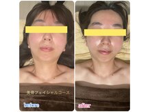 ラブリエ(LaBriller)の雰囲気（骨格ケアとオールハンドフェイシャルでリフトアップ！）