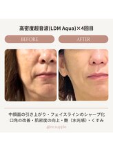 リサプリ(Re: Supple)/大人肌のハリ艶・透明感ケア