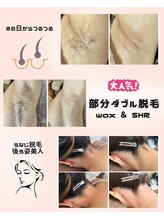 コネクト&nbsp;WAX脱毛 SHR脱毛