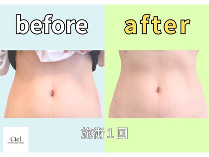 シエル(Ciel)の写真