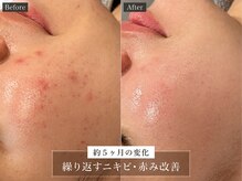 ルラシェ(Relacher)