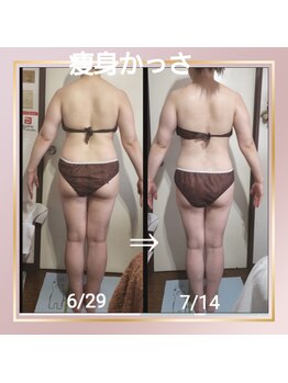 オアシス(OASIS)/全身痩身かっさ
