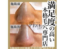 No.2【毛穴改善コース】頑固な開き、黒ずみ毛穴にお悩みの方