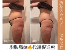 レヴィー(Revie)の雰囲気（筋肉と脂肪にWアプローチするRevie人気の組み合わせ施術）