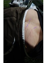 かもまさ治療院/現場対応