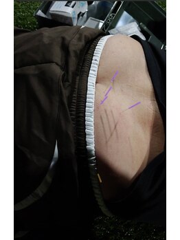 かもまさ治療院/現場対応