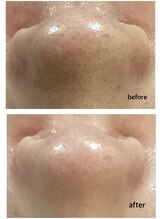 アイズ 横浜店(ize)/