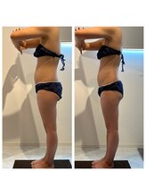 レヴール 京都四条烏丸店(Reveur)/お客様（ハイパーナイフ）1