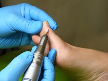 ひかわ整骨院 熊本巻き爪センター/フットケア