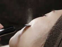 シンデレラストーリーの雰囲気（毛穴洗浄でザラツキ解消！肌悩みはニキビケアで艶肌へ♪）