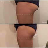 トゥジュール イエリック(Toujours ierik)