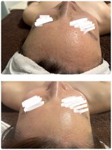 メディカルエステ ユウ(Yuu)/韓国ララピール