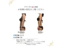 骨盤の角度を整え、美しいシルエットに★