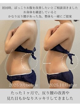 リニューサロン 本院(renew salon)/【エステ】整体×マッサージ