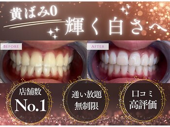 エクシアホワイトニング 調布店