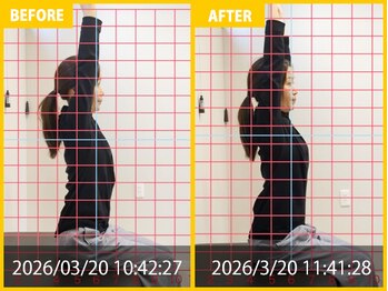 整体院 元 くまなん店/40代女性 首の痛みの悩み