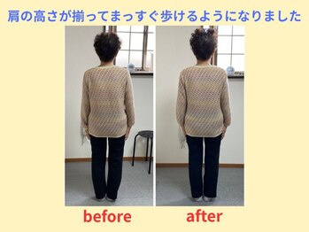 はしもと鍼灸整骨院/整体before→after