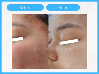 トウメイコガオ 横浜店/トウメイコガオでハーブ