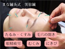 まな鍼灸整骨院/美容鍼