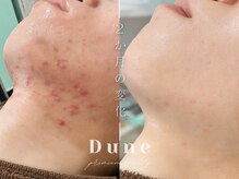 デューン 蕨店(Dune)