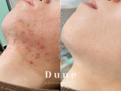 デューン 蕨店(Dune)の写真