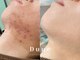 デューン 蕨店(Dune)の写真