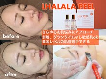 ブラウトクォーツ 渋谷松濤(broutquarts)の雰囲気（【正規販売店】韓国クリニック人気no1のララピール導入店！）