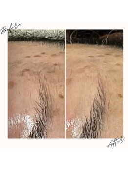 イチロクイチハチ(1618)/頑固なシミには