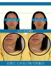 ハリラボ(hari Lab.)/【お客様の声】