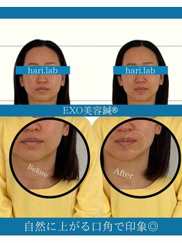 ハリラボ(hari Lab.)/【お客様の声】