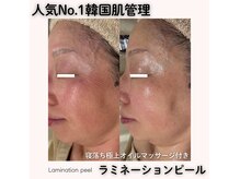 ココロ(COCORO)の雰囲気（COCORO人気No.1フェイシャルメニューぜひぜひ一度受けてみて）